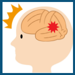 第14回脳科学豆知識「脳は傷ついても回復する？」のアイキャッチ画像